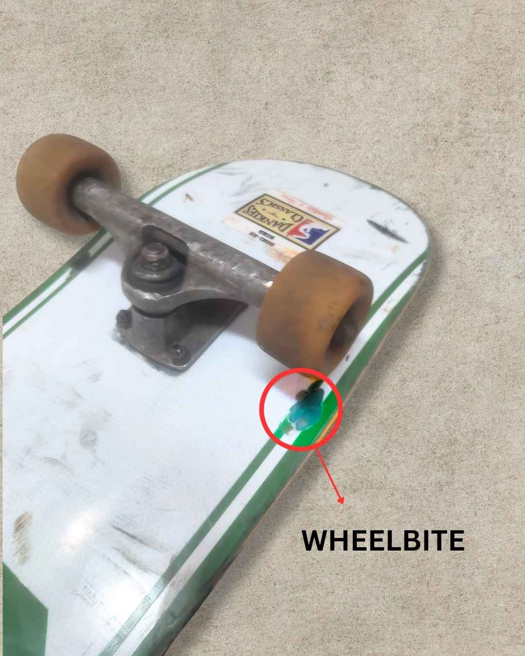 What Is Wheel Bite in Skateboarding?